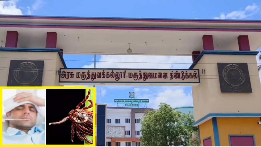 திண்டுக்கல் மாவட்டத்தை அச்சுறுத்தும் உண்ணிக் காய்ச்சல்!